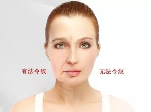 目前最好的除皱方法：目标用户，关注抗衰老、追求高品质生活的人群