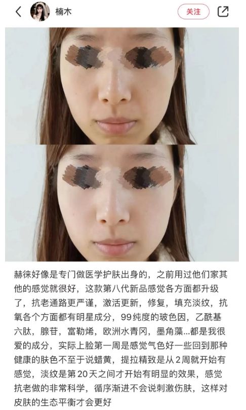 目前最好的除皱方法：目标用户，关注抗衰老、追求高品质生活的人群