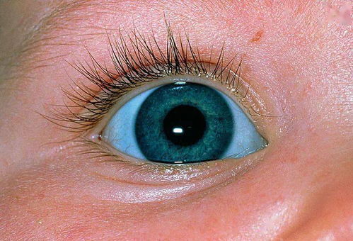 怎么判断眼睛是细菌还是病毒：如何判断眼睛是细菌还是病毒？这些症状或许能帮你初步区分