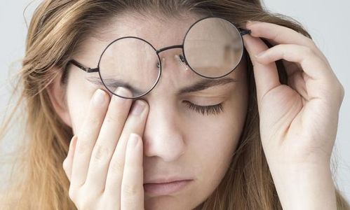 眼周过敏性皮炎皱巴巴:告别皱巴巴!眼周过敏性皮炎的救星在这里 眼周过敏性皮炎皱巴巴:告别皱巴巴!眼周过敏性皮炎的救星在这里