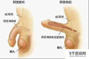 勃不起硬度不够吃什么药调理：勃起硬度不足？这些药物调理方法或许有效
