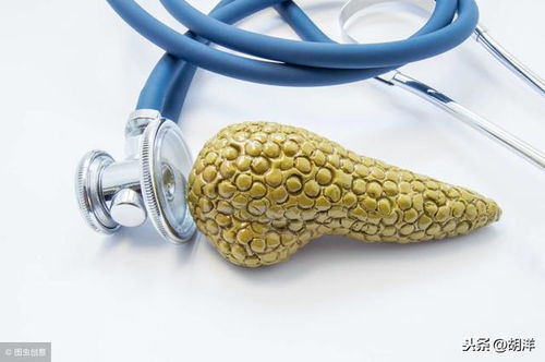 胰腺癌晚期能活多久：胰腺癌晚期生存期，影响因素与生活质量提升策略