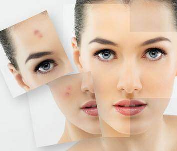 青春痘怎样才能消失:告别青春痘,科学方法助你重获光滑肌肤 青春痘怎样才能消失:告别青春痘,科学方法助你重获光滑肌肤