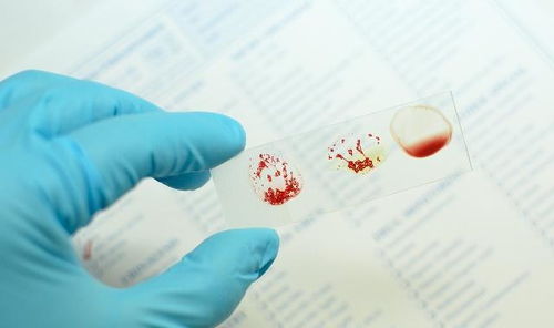 为什么要小心ab型血的人：AB型血人群，理解与相处的智慧