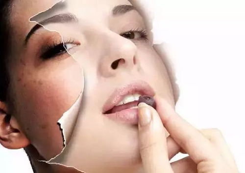 脸上斑越来越多怎么内调：脸上的斑点越来越多？别只顾外用，这些内调方法或许正你需要！