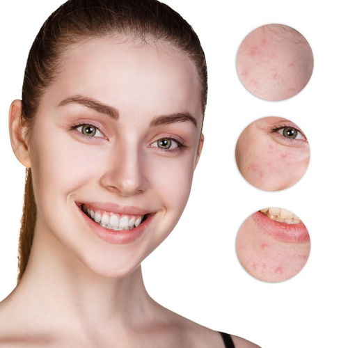 怎么去粉刺最快最有效：快速击退顽固粉刺！这3个速效方案让你肌肤重获洁净