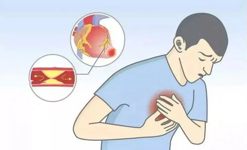 胸口痛预示着三种疾病：警惕！胸口痛可能预示着这三种疾病