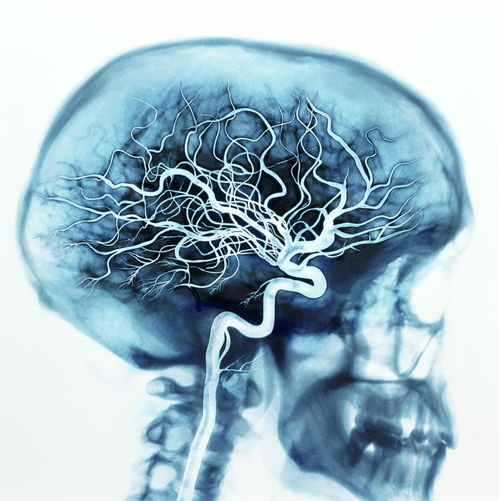 梦见死人是什么预兆 女性：梦里见了故人，女性梦见逝者的科学与文化解析