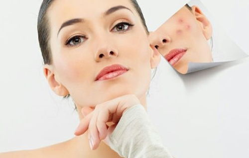 青春痘怎么去除：告别青春烦恼，科学方法彻底根除青春痘