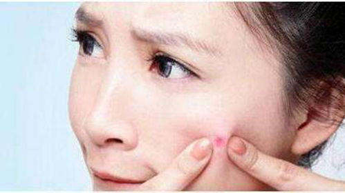 16岁痘痘怎么消除：16岁痘痘怎么消除？青春期痘痘护理全攻略