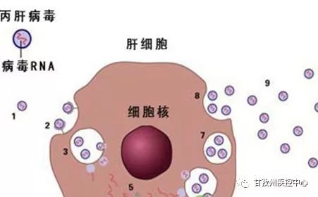 女士生殖疱疹图片大全：女性生殖疱疹，认识、预防与治疗