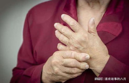 类风湿针一万多一针：一针1万多！揭秘类风湿关节炎的天价治疗费用