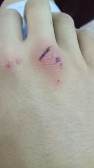 梦见别人受伤流血财运走向：梦见别人受伤流血，财运走向会受影响吗？梦境与财运的隐秘关联