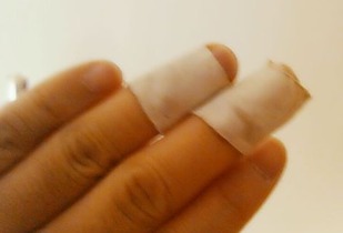 梦见别人受伤流血财运走向：梦见别人受伤流血，财运走向会受影响吗？梦境与财运的隐秘关联