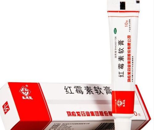 肛门瘙痒用什么药膏：肛门瘙痒用什么药膏？这些药膏推荐和使用指南请收好