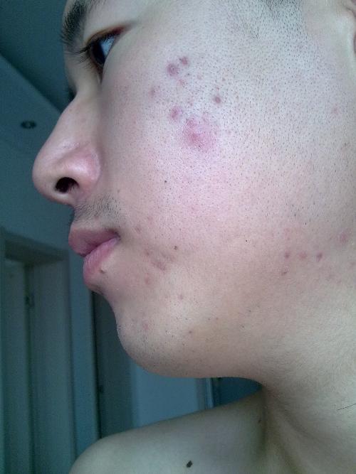 脸上不吉利的痣:脸上不吉利的痣,从民间传说到科学解读 脸上不吉利的痣:脸上不吉利的痣,从民间传说到科学解读