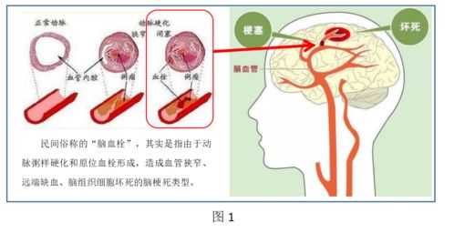 梦到出血是什么预兆：梦到出血是什么预兆？血色迷雾中的科学与玄学碰撞