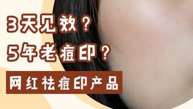 长痘印怎么去除：告别痘印困扰！这些方法真的有用，教你有效去除顽固痘印