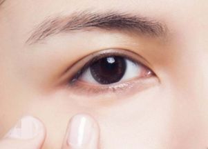 消除眼袋皱纹：彻底告别眼袋与皱纹，自然、有效的双眼焕新指南
