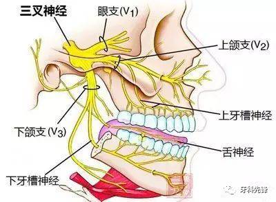 坐骨神经痛的疼点图：坐骨神经痛疼痛点图解析，让你直观了解疼痛范围与位置