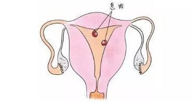 射精出血是什么原因造成的：射精出血是什么原因造成的？