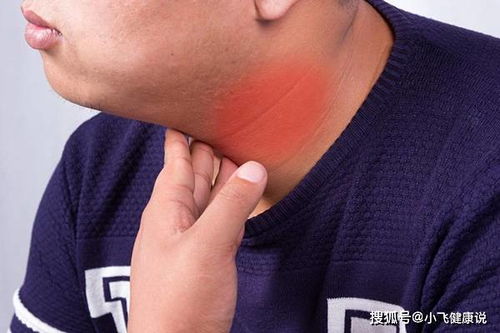 甲状腺结节不能吃六种食物:甲状腺结节患者必看,这六种食物要远离! 甲状腺结节不能吃六种食物:甲状腺结节患者必看,这六种食物要远离!