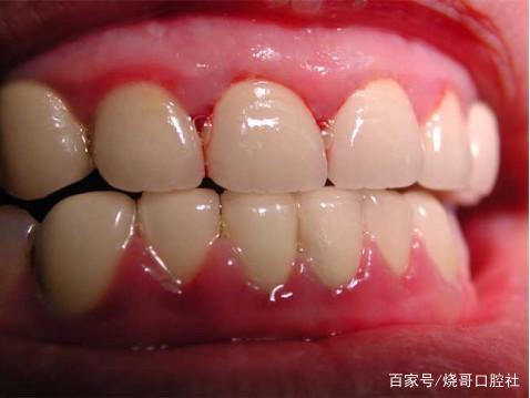 女人梦见牙齿松动但没脱落：梦里牙齿松动却未脱落，一场关于不安与希望的隐喻