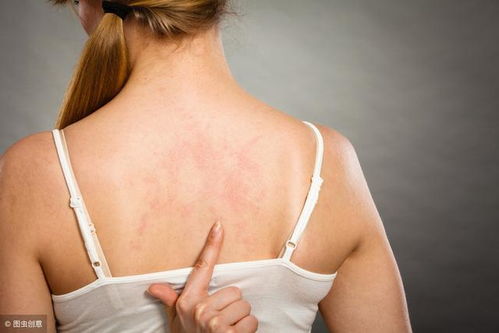 识别皮肤病：你真的能识别出这些皮肤病吗？