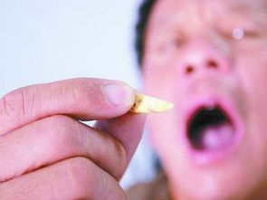 女人梦见掉了很多牙齿：女人梦见掉了很多牙齿，解析梦境背后的隐喻与心理暗示