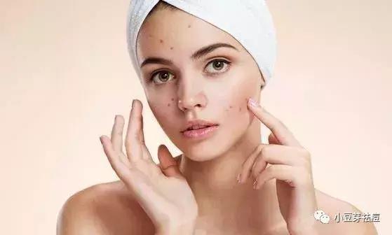 面部痘印如何消除：告别顽固痘印，轻松拥有无瑕肌肤的实用指南