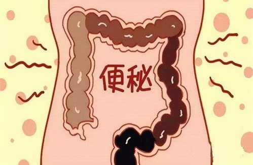 便秘怎么办:便秘怎么办?这些方法真的有效!