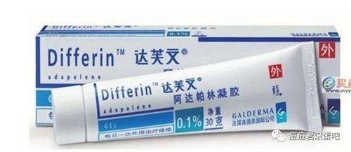 阿达帕林凝胶可以去黑头吗：阿达帕林凝胶可以去黑头吗？一篇详细解析助你了解