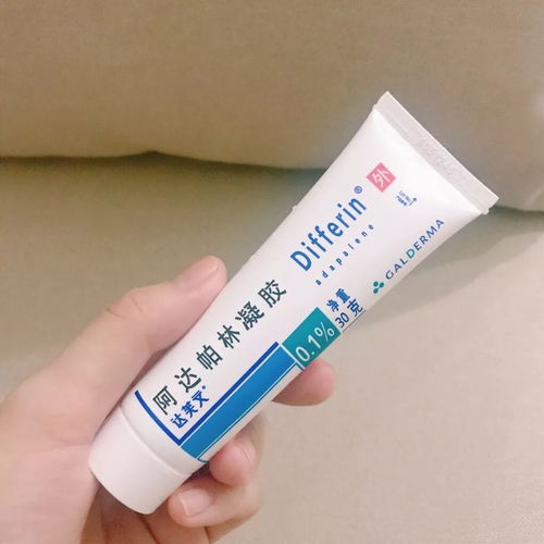 阿达帕林凝胶可以去黑头吗:阿达帕林凝胶可以去黑头吗?一篇详细解析助你了解