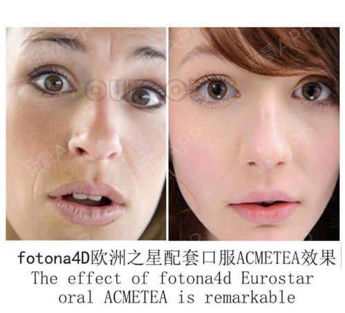 眼部矫正手术大概需要多少钱：眼部矫正手术价格参考，全面解析费用构成与选择要点