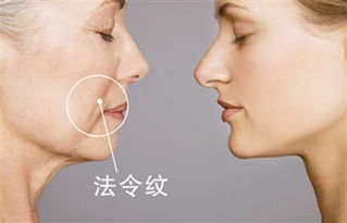 怎样去除法令纹最见效：法令纹困扰？这5招组合拳助你快速淡化法令纹