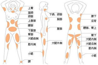 大腿抽脂:大腿抽脂,全面解析,了解吸脂塑形的科学与选择 大腿抽脂:大腿抽脂,全面解析,了解吸脂塑形的科学与选择