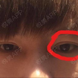 男人左眼皮跳是吉还是凶:男人左眼皮跳是吉还是凶?传统智慧与现代视角的辩证解读 男人左眼皮跳是吉还是凶:男人左眼皮跳是吉还是凶?传统智慧与现代视角的辩证解读