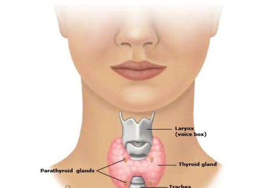 甲状腺4c必须手术吗:甲状腺4c结节,必须手术吗?权威解读与个性化决策指南