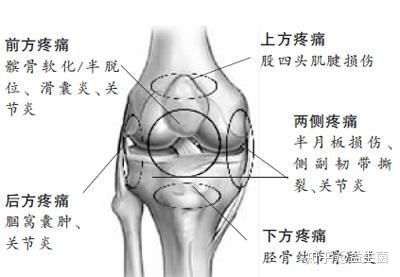 海绵体损伤该如何恢复:海绵体损伤恢复指南,从了解原因到重建健康功能 海绵体损伤该如何恢复:海绵体损伤恢复指南,从了解原因到重建健康功能