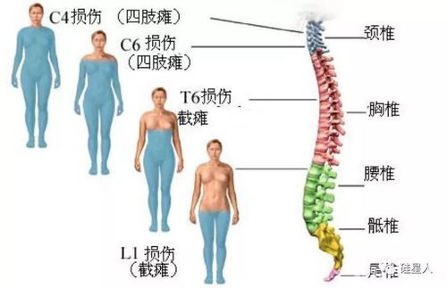 海绵体损伤该如何恢复:海绵体损伤恢复指南,从了解原因到重建健康功能