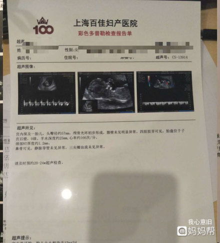 nt检查需要空腹吗:nt检查需要空腹吗?答案来了! nt检查需要空腹吗:nt检查需要空腹吗?答案来了!