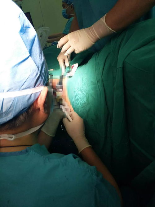 痔疮手术一个人去行吗:痔疮手术可以一个人去吗?你需要知道这些!