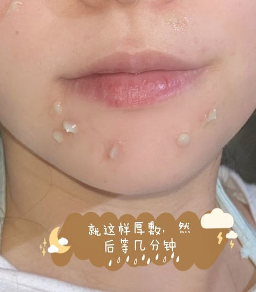 肌漾祛痘印有效果吗:肌漾祛痘印有效果吗?真实体验分享与分析 肌漾祛痘印有效果吗:肌漾祛痘印有效果吗?真实体验分享与分析