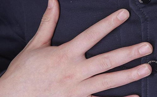 手指发麻是什么原因:手指发麻,原因竟有这些!快来看看你的症状属于哪种