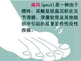 痛风在脚的哪个位置图:痛风在脚的哪个位置图,认识痛风的典型发作部位