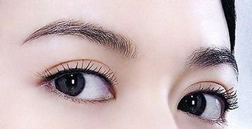 埋线双眼皮过程视频：揭秘，埋线双眼皮全过程视频展示，无创双眼皮手术新选择！