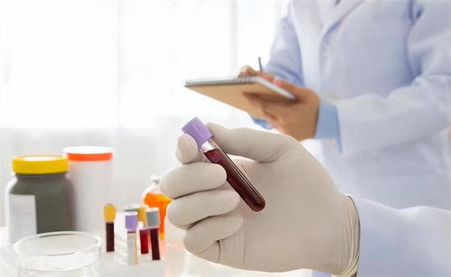 心肌缺血吃什么药管用：心肌缺血吃什么药管用？这5类药物需了解