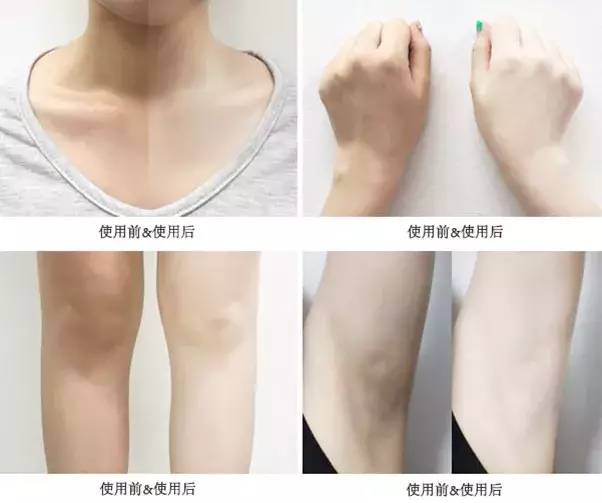 皮肤黄怎么变白最快方法:科学美白,健康提亮,皮肤偏黄快速变白的有效方法 皮肤黄怎么变白最快方法:科学美白,健康提亮,皮肤偏黄快速变白的有效方法