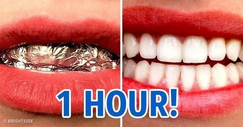 牙冠和牙套是一回事吗:牙冠和牙套是一回事吗? 牙冠和牙套是一回事吗:牙冠和牙套是一回事吗?