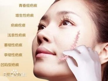 梦见自己受伤出血:梦中流血,那些被忽视的伤口与未言的心事 梦见自己受伤出血:梦中流血,那些被忽视的伤口与未言的心事